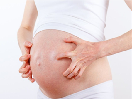 準媽媽皮膚瘙癢，可適當用藥！